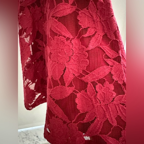 Forever 21 dress bundle - Picture 2 of 10